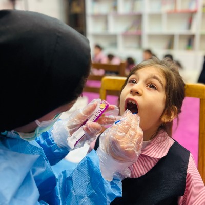 وارنیش / فلورایدتراپی